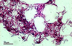 Airborne bacteria