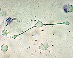A macrophage stretching its "arms" (filopodia)[40] to engulf two particles, possibly pathogens, in a mouse (trypan blue exclusion staining).