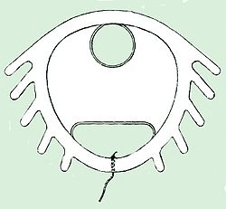 2013 sketch of a Dalkon Shield; Ross was one of the first women of color who won the lawsuit against A.H. Robbins for their defective IUD (intrauterine device).
