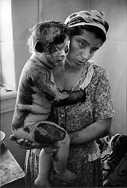 A Chechen woman with a wounded child