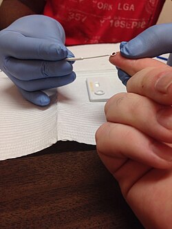 HIV rapid test being administered