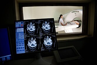 A clinical neuroradiology acquisition workstation. Disruption of the blood–brain barrier is assessed by imaging contrast enhancement profiles on cross-sectional CT and MRI slices to differentiate tumor margins from normal brain structures.