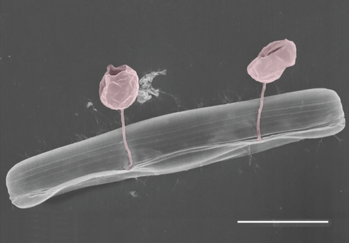 Pennate diatom from an Arctic meltpond, infected with two chytrid-like [zoo-]sporangium fungal pathogens (in false-colour red). Scale bar = 10 μm.[43]