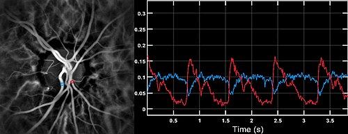 Blood flow velocity waveforms in the central retinal artery (red) and vein (blue), measured by laser Doppler imaging in the eye fundus of a healthy volunteer.