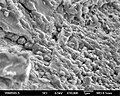Y000593