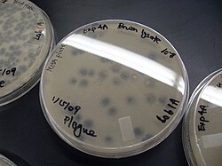 Plaques from a virus isolated from a compost heap near UCLA. The bacterium is M. smegmatis.
