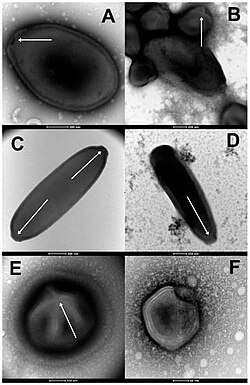 Some of the ancient amoeba-eating viruses revived by the research team of Jean-Michel Claverie. Clockwise from the top: Pandoravirus yedoma; Pandoravirus mammoth and Megavirus mammoth; Cedratvirus lena; Pithovirus mammoth; Megavirus mammoth; Pacmanvirus lupus.[17]