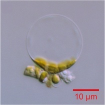 Thalassiosira pseudonana was the first eukaryotic marine phytoplankton to have its genome sequenced