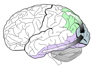 The visual dorsal stream (green) and ventral stream (purple) are shown. Much of the human cerebral cortex is involved in vision.