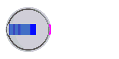 A wheel type radiotherapy device which has a long collimator to focus the radiation into a narrow beam. The caesium-137 chloride radioactive source is the blue square, and gamma rays are represented by the beam emerging from the aperture. This was the radiation source involved in the Goiânia accident, containing about 93 grams of caesium-137 chloride.