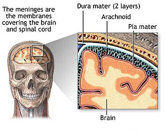 The meninges lie between the skull and brain matter. Tumors originating from the meninges are meningiomas.