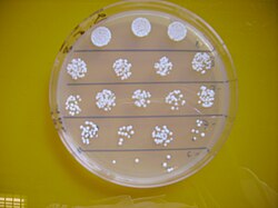 While some wine regions view the influence of Brettanomyces on the wine, in limited amounts, as added complexity, many winemakers view the presence of Brettanomyces species such as Brettanomyces bruxellensis (pictured) in their wineries as a negative influence that needs to be controlled.