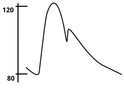 A schematic representation of the arterial pressure waveform over one cardiac cycle. The notch in the curve is associated with closing of the aortic valve.