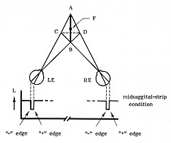Midsagittal-strip illusion. In 3D plane CD is seen, AB is not.