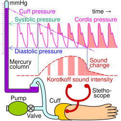 Measuring systolic and diastolic blood pressure using a mercury sphygmomanometer