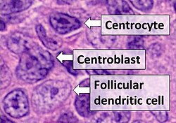 Histologic comparison of cell types in a germinal center, including follicular dendritic cells, H&E stain:- Centrocytes are small to medium size with angulated, elongated, cleaved, or twisted nuclei.- Centroblasts are larger cells containing vesicular nuclei with one to three basophilic nucleoli apposing the nuclear membrane.- Follicular dendritic cells have round nuclei, centrally located nucleoli, bland and dispersed chromatin, and flattening of adjacent nuclear membrane.