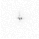 Slow motion movie of the image seen at a telescope when looking at a star at high magnification (negative images). The telescope used had a diameter of about 7r0 (see definition of r0 below, and example simulated image through a 7r0 telescope). The star breaks up into multiple blobs (speckles) – entirely an atmospheric effect. Some telescope vibration is also noticeable.