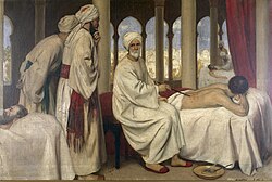 The Andalusian physician Abu'l Qasim Al-Zahrawi, who performed the first modern surgery, determined how to remove kidney stones, was known as the father of surgery, and developed many inventions and instruments.
