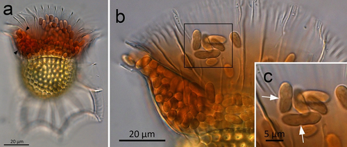 Cyanobionts of Ornithocercus dinoflagellates [111] Live cyanobionts (cyanobacterial symbionts) belonging to Ornithocercus dinoflagellate host consortium(a) O. magnificus with numerous cyanobionts present in the upper and lower girdle lists (black arrowheads) of the cingulum termed the symbiotic chamber.(b) O. steinii with numerous cyanobionts inhabiting the symbiotic chamber.(c) Enlargement of the area in (b) showing two cyanobionts that are being divided by binary transverse fission (white arrows).