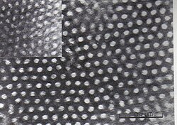 SBS block copolymer seen with transmission electron microscopy (TEM)