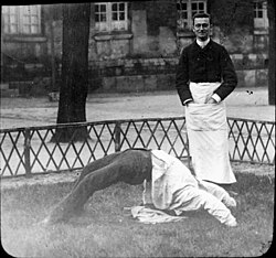 Albert Londe's photograph of a male Salpêtrière patient exhibiting the same contortions as those displayed in Richer's charcoal drawing