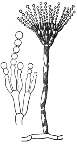 Conidia on conidiophores