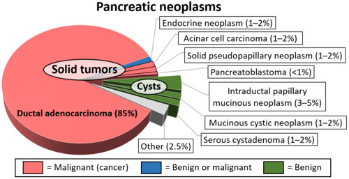 Relative incidences of various pancreatic neoplasms, with pancreatic cancers in red/pink color[27]
