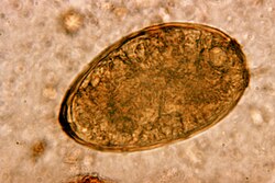 Microlecithal eggs from the flatworm Paragonimus westermani