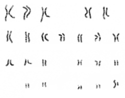 Micrographic karyogram of human male, showing 23 pairs of chromosomes. The largest chromosomes are around 10 times the size of the smallest.[53]