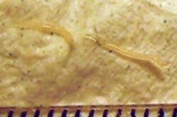 Two pinworms next to a ruler, measuring 6 millimeters in length