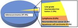 Relative incidence of various histopathological types of colorectal cancer. The vast majority of colorectal cancers are adenocarcinomas.[96]